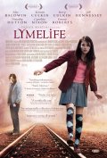 смотреть фильм Роскошная жизнь / Lymelife онлайн бесплатно без регистрации